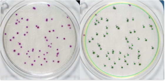 Colony Forming Units (CFU) in Bacteria Culture